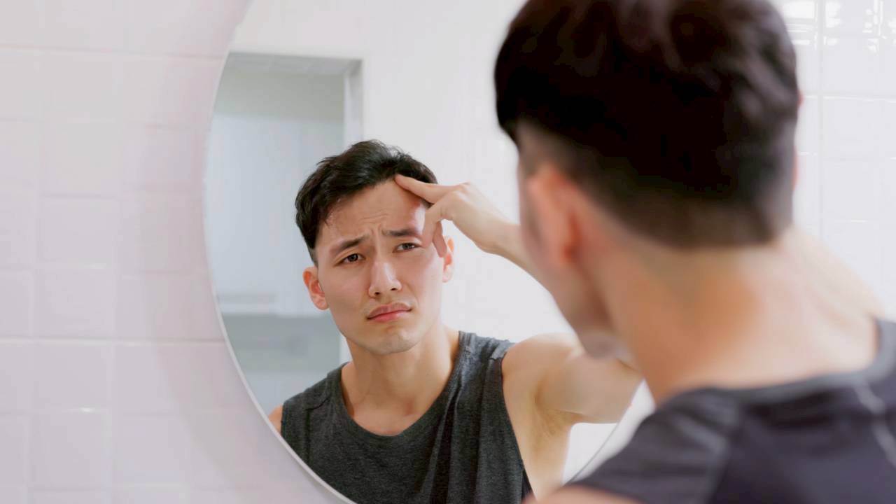 AGAの原因に悩む男性